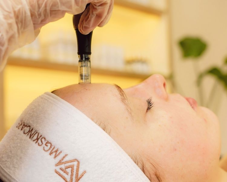 Woman having a skin needling facial