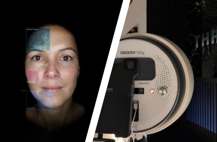 Split photo of a scan of a womans face and the scanning machine at thriyv clinic in manchester