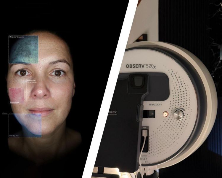 Split photo of a scan of a womans face and the scanning machine at thriyv clinic in manchester