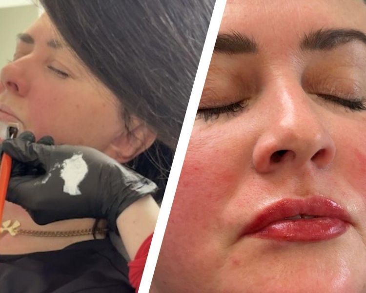 Split photo showing a lip blush treatment and end result of treatment